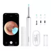 Limpiador de oídos Bebird T15 Smart Visual blanco — otoscopio visual para la limpieza de oídos
