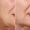 Dispositivo silk'n FaceTite FTC1PE1001 tecnología de rejuvenecimiento de la piel – tensado y contorno facial profesional