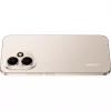 Honor 400 16,6 cm (6,55