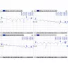 Cable Mmcx a RPSMA/ACMMCXRPSMA Mikrotik
