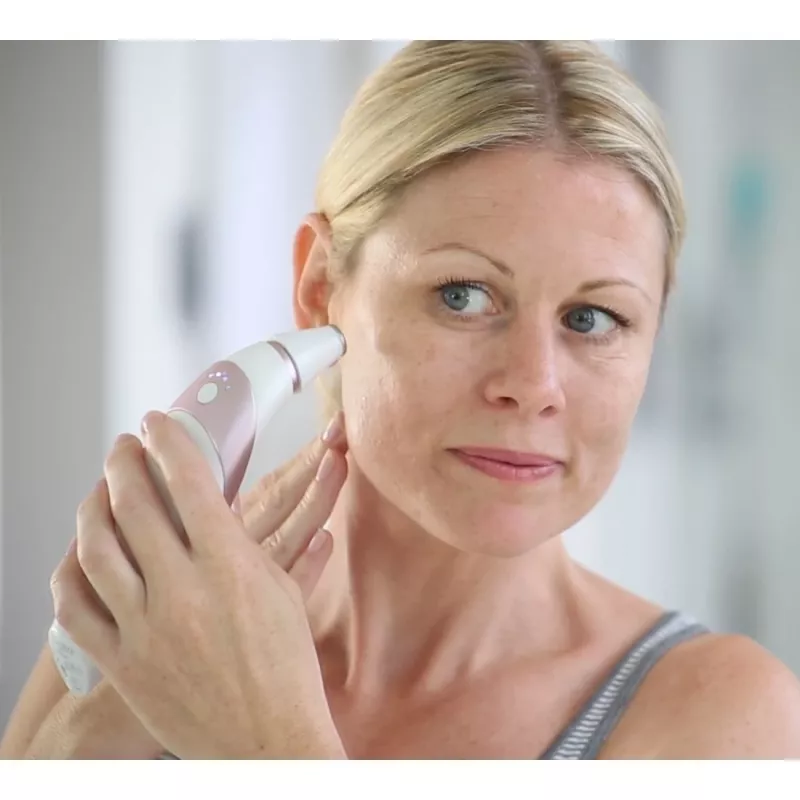 HoMedics Radiance aparato de cuidado de la piel aspiración cutánea microdermoabrasión oro rosa, blanco