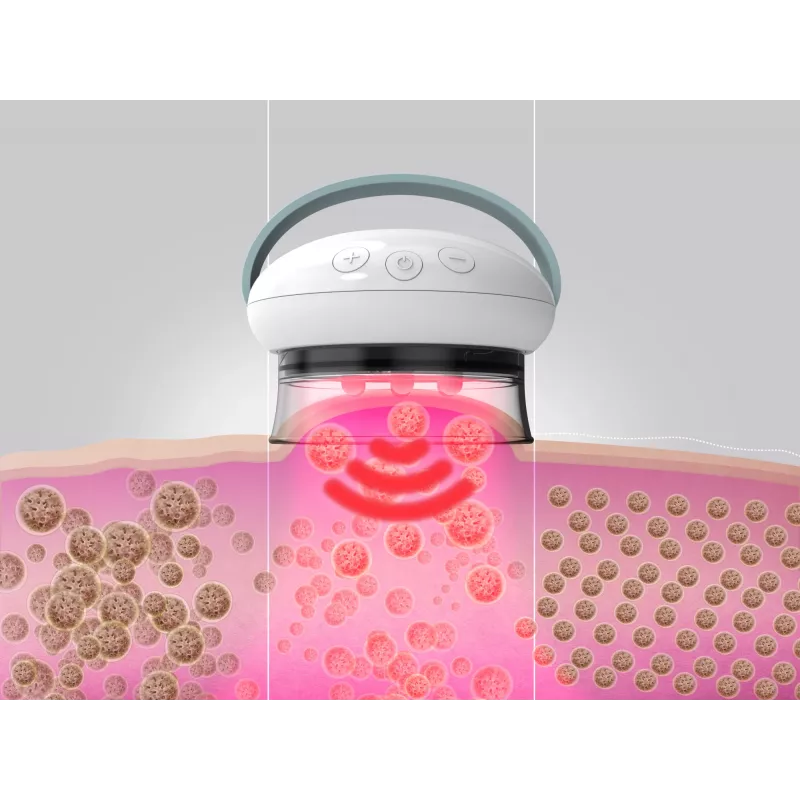 Masajeador de piernas HoMedics Smoothee IR blanco 4 cabezales a pilas