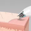 Aparato de cuidado de la piel HoMedics MD-1000-EU2 microdermoabrasión por vacío blanca