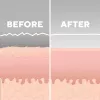 Aparato de cuidado de la piel HoMedics MD-1000-EU2 microdermoabrasión por vacío blanca