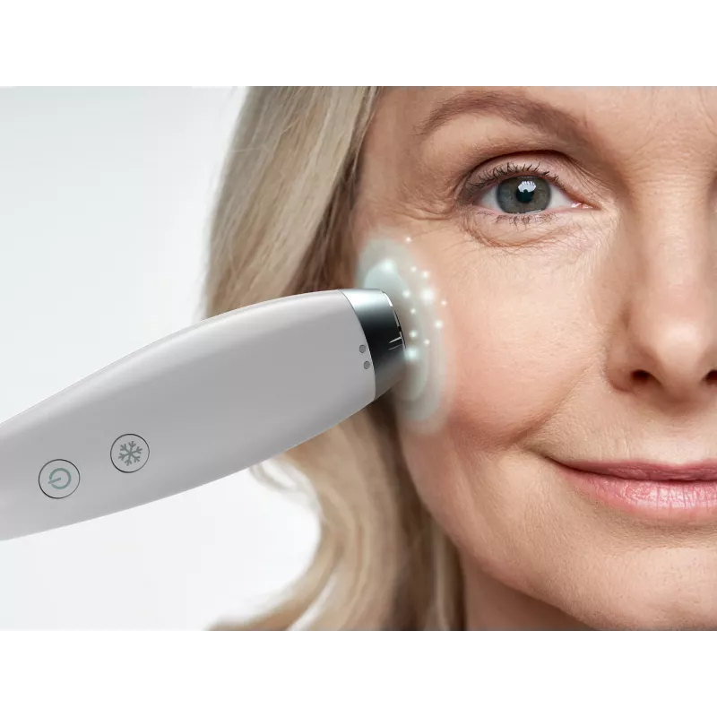 Aparato de cuidado de la piel HoMedics MD-1000-EU2 microdermoabrasión por vacío blanca