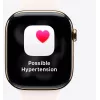 Smartwatch Apple MFD04ET/A — Apple Watch (Modelo MFD04ET/A)