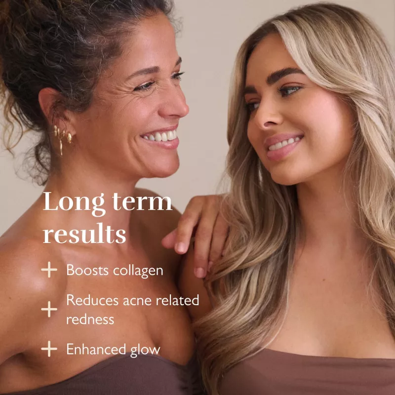 Silk'n LED Face Mask Pro FLMP1PE1001 - mascarilla de fototerapia LED antiaging y acné