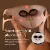 Silk'n LED Face Mask Pro FLMP1PE1001 - mascarilla de fototerapia LED antiaging y acné