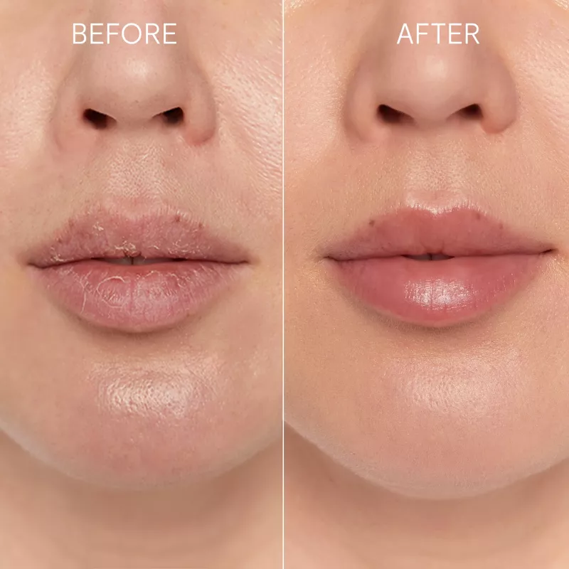 GLOV Scrubex Lip Exfoliating Mitt - pack de 2 | Exfoliante de labios suave de microfibra para unos labios sedosos