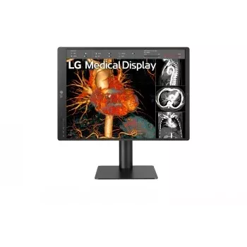 LG 21,3