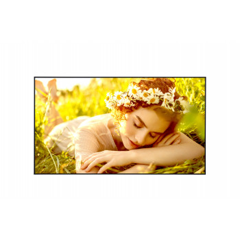 LG 50UL5Q-M - Pantalla UHD Mid estándar de 50