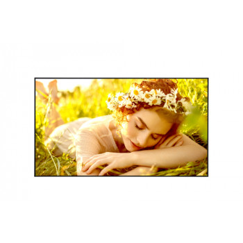 LG 50UL5Q-M - Pantalla UHD Mid estándar de 50